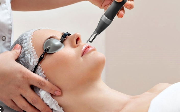 Laser Photo facial
